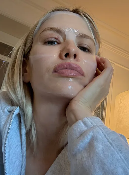 Елена Перминова получила ожоги век