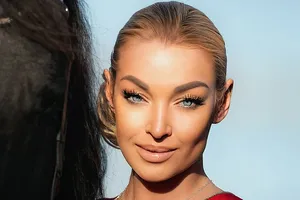 «Я потеряла много крови во время операции»: Анастасия Волочкова рассказала о том, что пережила в Германии