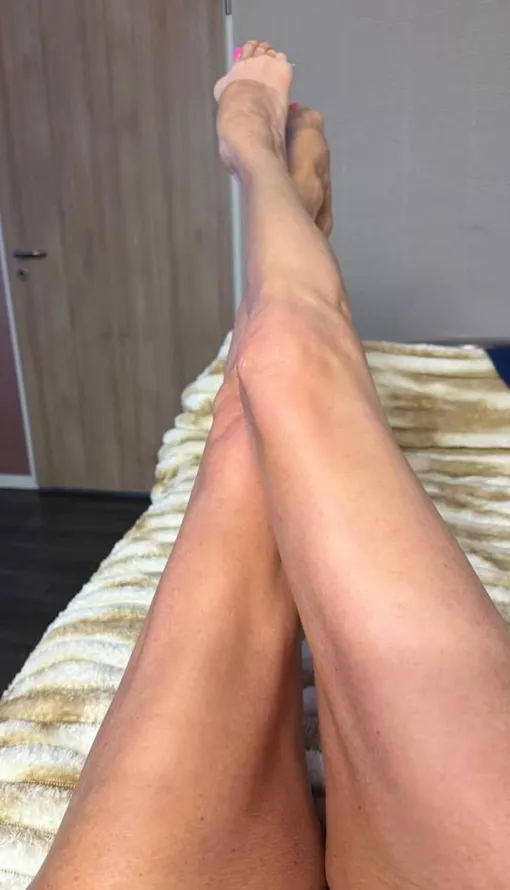 Анастасия Волочкова перенесла операцию на ноге