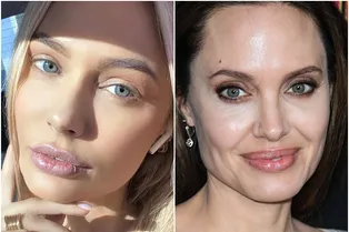 «Я Анджелина Джоли!»: Наталья Рудова показала результат увеличения губ «Я Анджелина Джоли!»: Наталья Рудова показала результат увеличения губ