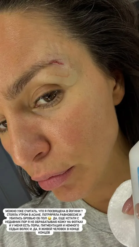 Зиверт получила травму