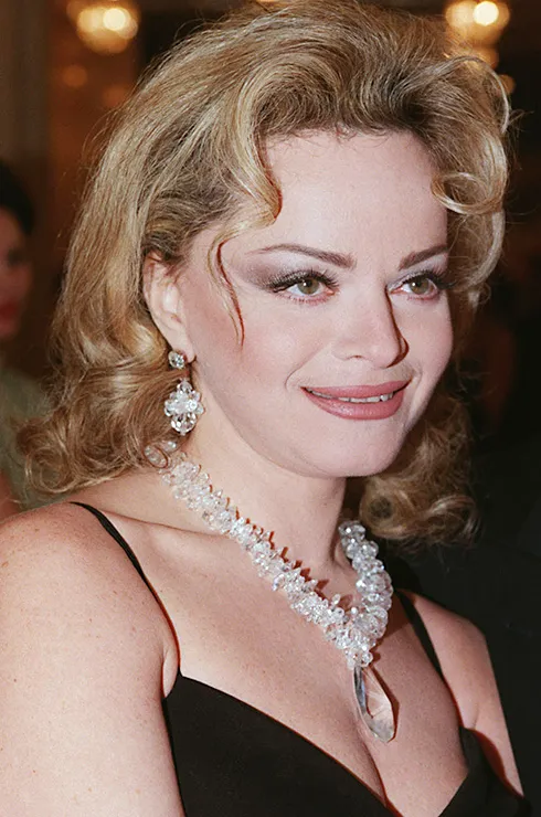 Российские знаменитости после пластики