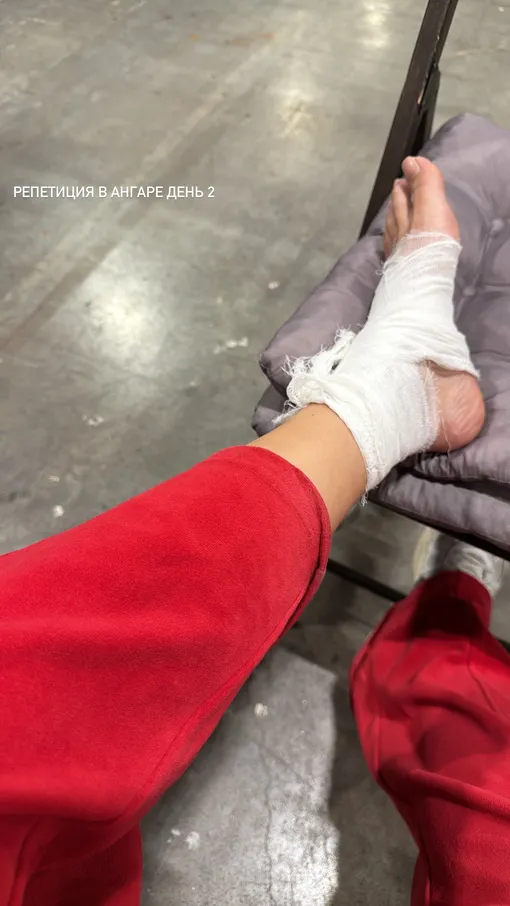 Юлия Зиверт вывихнула ногу во время репетиции