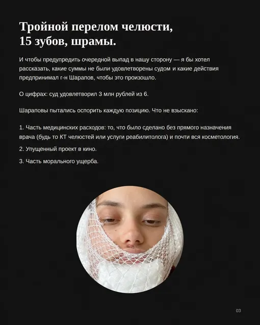 Алена Митрошина сильно пострадала в результате ДТП Алена Митрошина сильно пострадала в результате ДТП