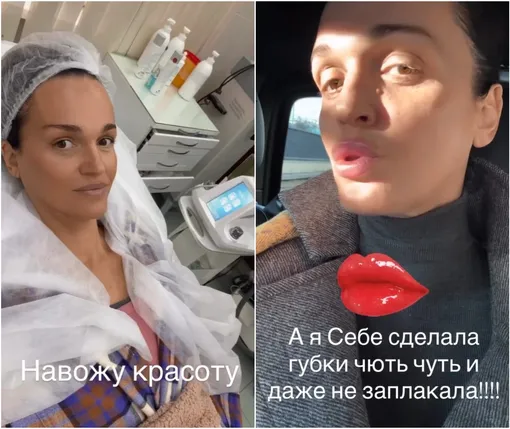 Слава до и после процедуры