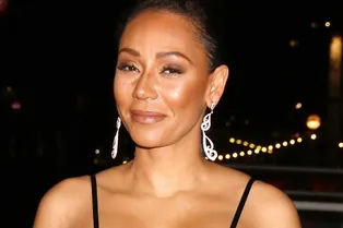 Ослепшая на один глаз Мел Би ищет повязку как у Мадонны Ослепшая на один глаз Мел Би ищет повязку как у Мадонны