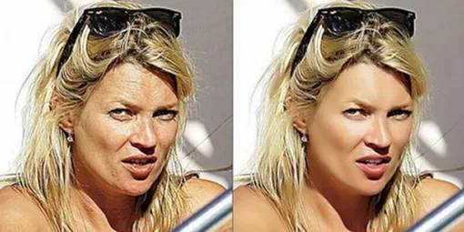 звезды без фотошопа фото до и после звезды без фотошопа фото до и после