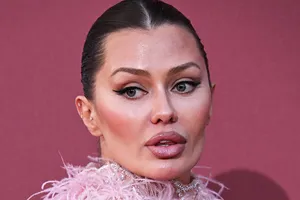«Моя нога сильно заболела и почернела»: Виктория Боня показала травмированную конечность