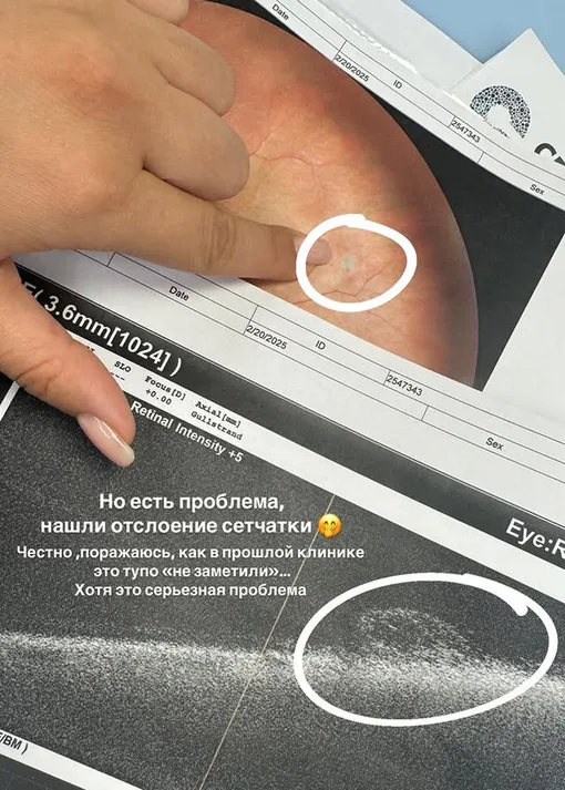 Майя Донцова готовится к операции на зрение Майя Донцова готовится к операции на зрение