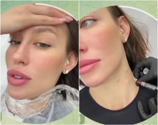 Валентина Иванова у косметолога