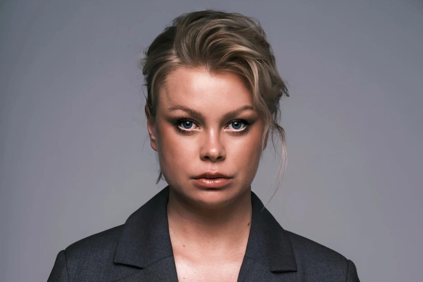 Звезда сериалов Евгения Осипова побрилась налысо и перенесла пересадку волос