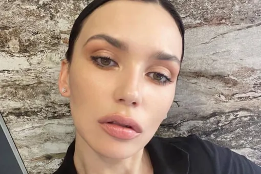 «Ничего не стесняюсь! Сожгла пилингом!»: Ольга Серябкина показала покрасневшее лицо без фильтров и макияжа