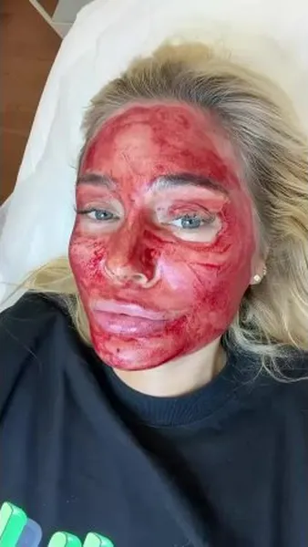 Нажми и смотри