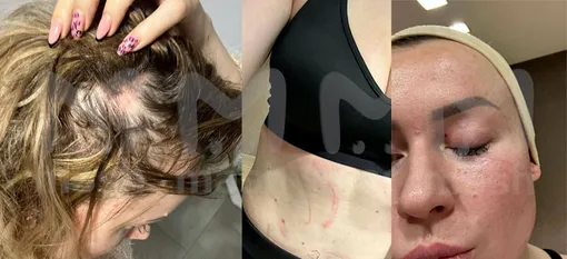 Сара Окс получила повреждения в браке с девушкой в фитнес-центре