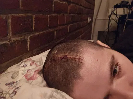 Ира Небога вела честный блог о своей болезни