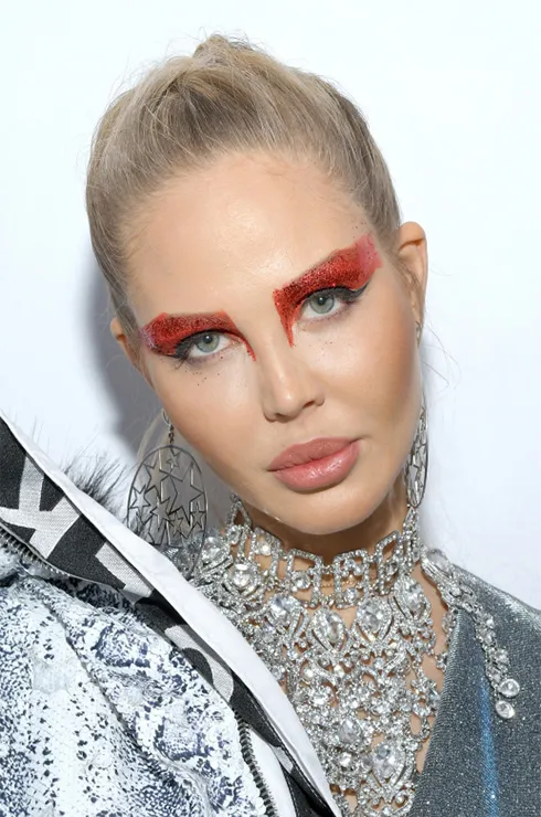 звезды губы до и после