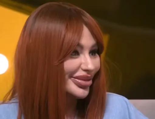 Александра Домбаева не представляет себя без больших губ