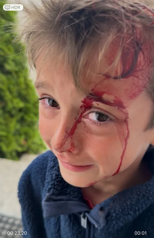 Наталья Штурм показала внука, истекающего кровью