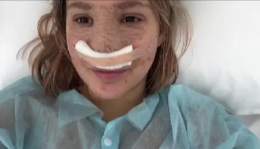 Дочь Даны Борисовой сделала ринопластику Дочь Даны Борисовой сделала ринопластику