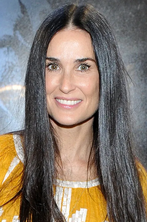 у кого из звезд стоят виниры