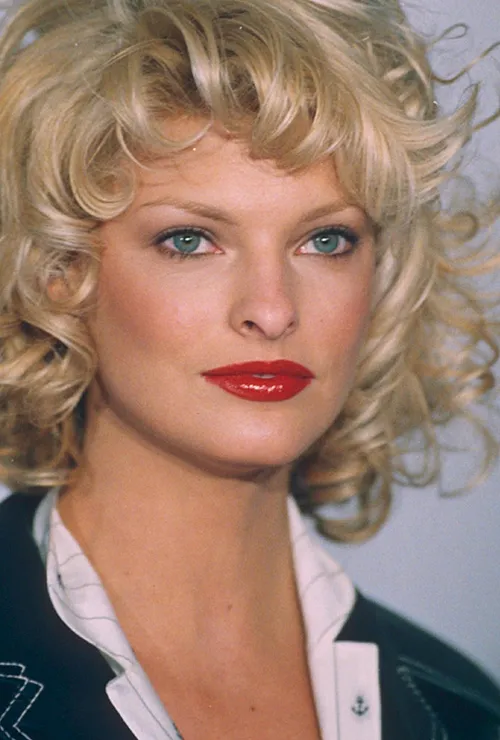 блефаропластика верхних век звезды до и после