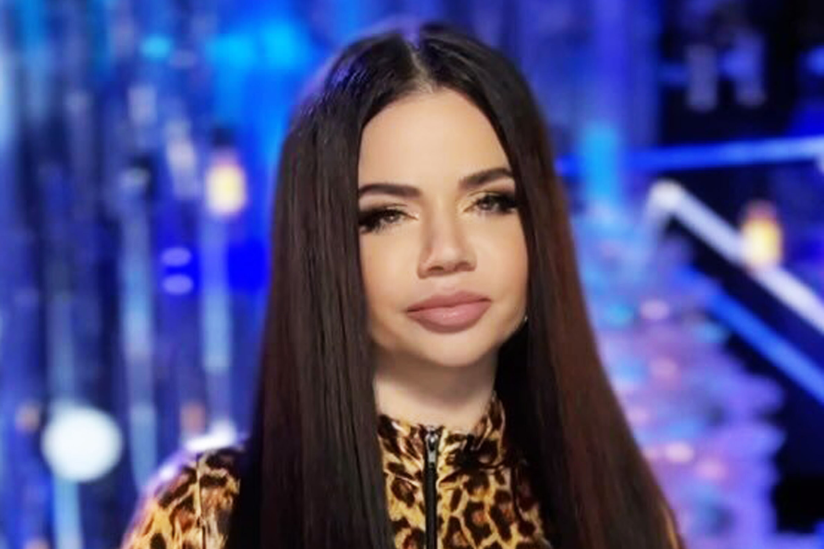 Певица Бьянка призналась, что сделала пластику по подтяжке лица и удалению комков Биша