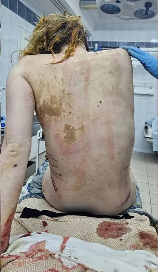Анастасия Прокофьева попала в больницу в тяжелом состоянии Анастасия Прокофьева попала в больницу в тяжелом состоянии