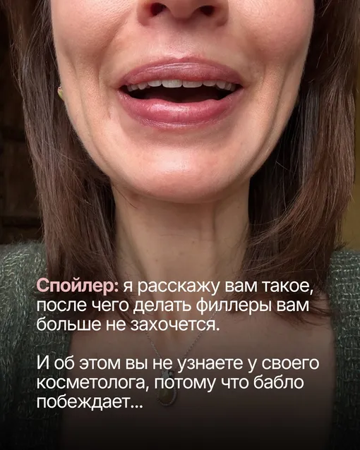 Ирина Муромцева пострадала из-за филлеров Ирина Муромцева пострадала из-за филлеров