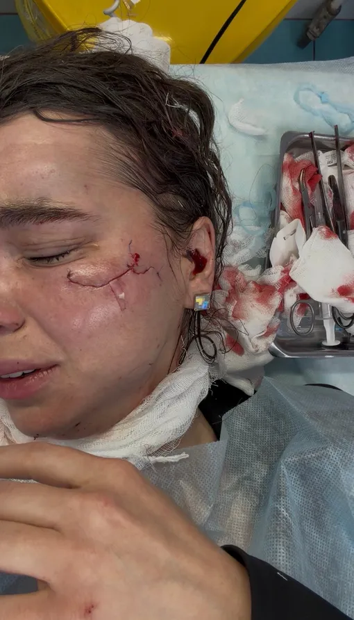 Надежда Шустова серьезно пострадала Надежда Шустова серьезно пострадала