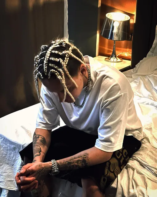 Егор Шип готовится к операции на левый глаз