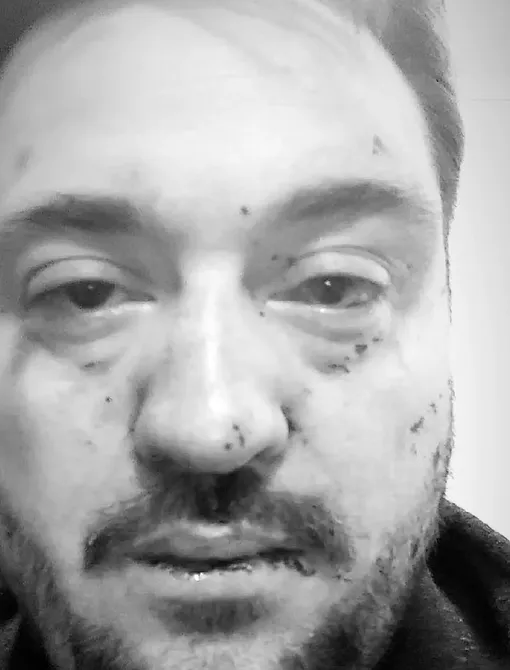 Руслан Алдонин пообещал найти нападавших и добиться справедливости Руслан Алдонин пообещал найти нападавших и добиться справедливости