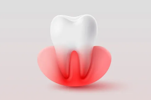 что будет если не почистить зубы на ночь что будет если не почистить зубы на ночь