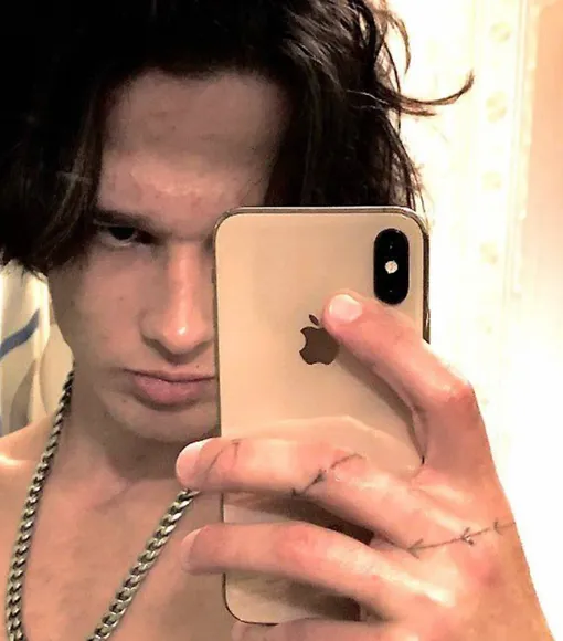 Максима спасли медики и доставили в больницу Максима спасли медики и доставили в больницу