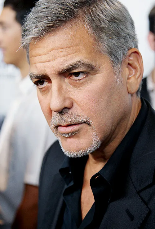 звезды до и после блефаропластики