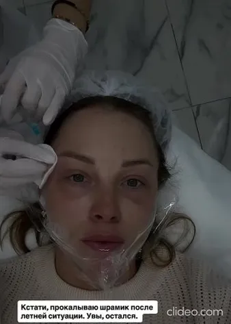 Нажми и смотри Нажми и смотри