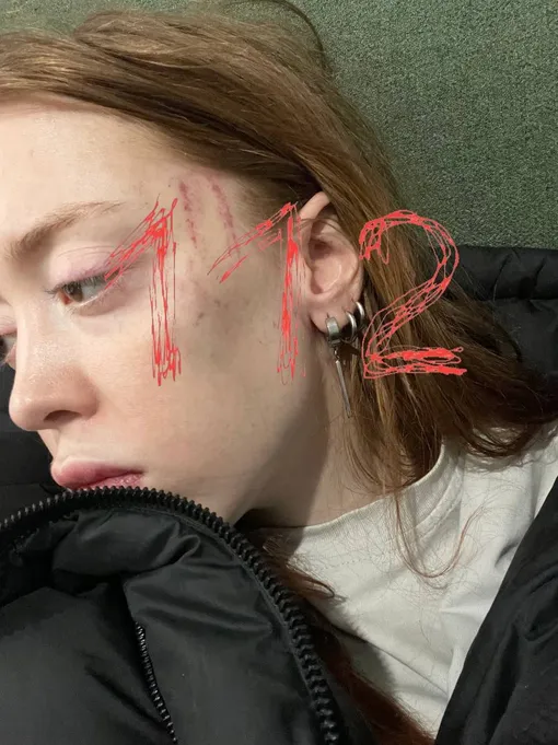 Арина заявила, что муж ее избил