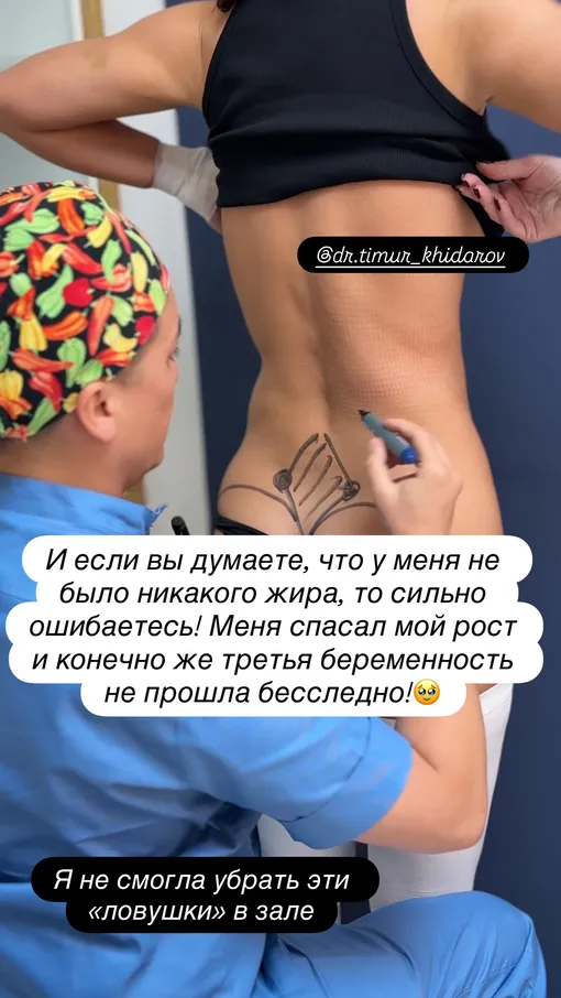 Тимур Хайдаров сам оперировал жену Тимур Хайдаров сам оперировал жену