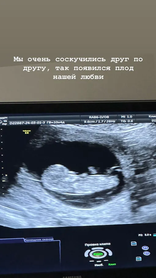 Мария Погребняк показала снимок УЗИ младшего сына Мария Погребняк показала снимок УЗИ младшего сына
