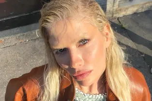 «Получила сильнейший ожог кожи»: Елена Перминова не выходит из дома из-за травмы