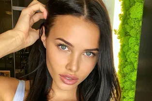 Анастасия Решетова поклялась, что не делала уколы в лицо, кроме верхней губы Анастасия Решетова поклялась, что не делала уколы в лицо, кроме верхней губы