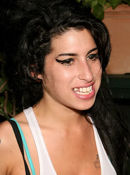 зубы знаменитостей