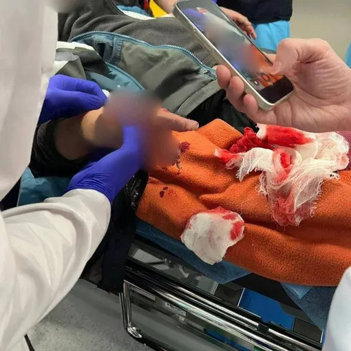 Глеба оперировали шесть часов