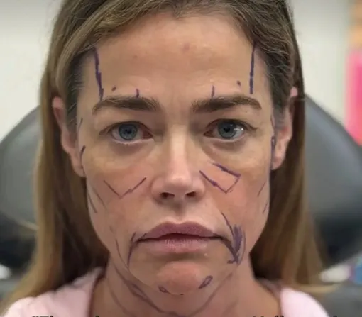 Дениз Ричардс сделала пластику