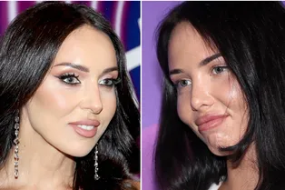 «Любовницу проклинают, но виноват мужчина»: Алсу после развода простила Анастасию Решетову