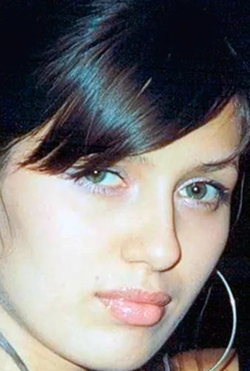 блефаропластика звезд фото до и после