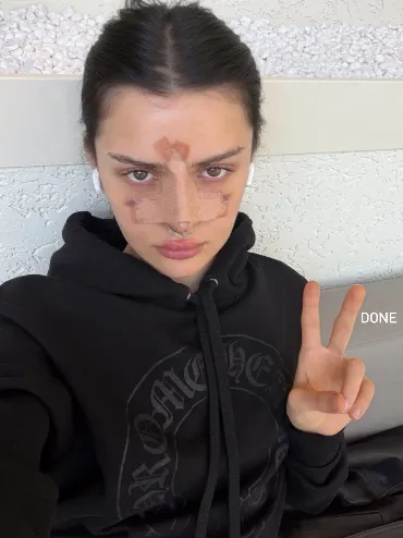 Дина Саева тоже делала пластическую операцию