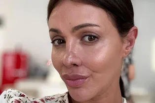 «После операции мой нос превратился в лепесток»: Алиса Аршавина винит себя в жутком изменении лица