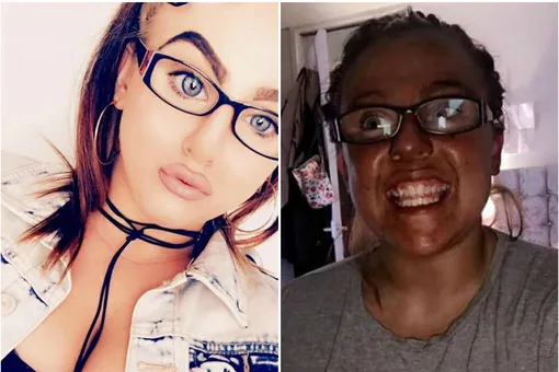 Искусственный загар превратил 23-летнюю англичанку в мулатку! Искусственный загар превратил 23-летнюю англичанку в мулатку!