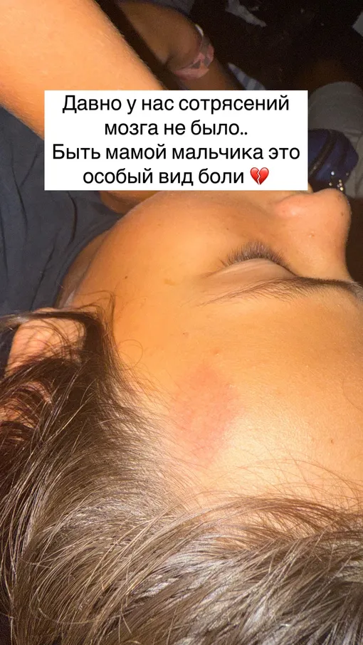 Сэм получил сотрясение мозга Сэм получил сотрясение мозга