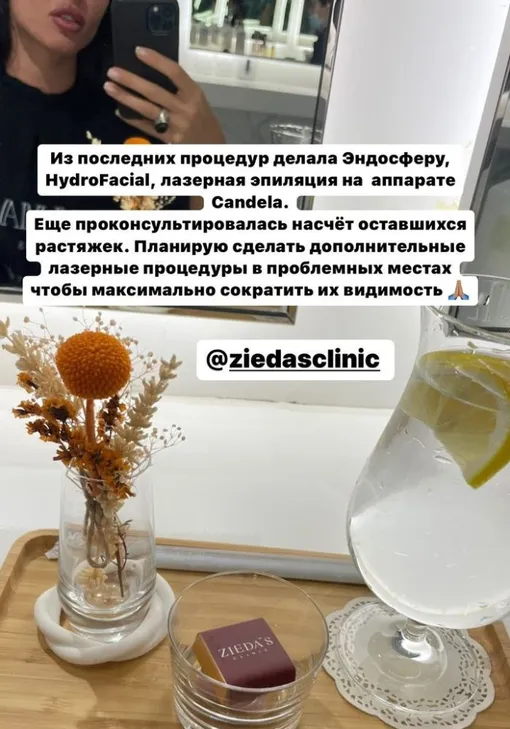 Анастасия Решетова рассказала, как борется с растяжками Анастасия Решетова рассказала, как борется с растяжками